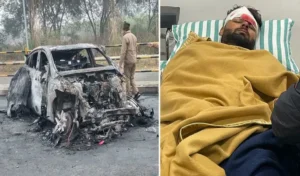 a man lying in a bed with a burnt car